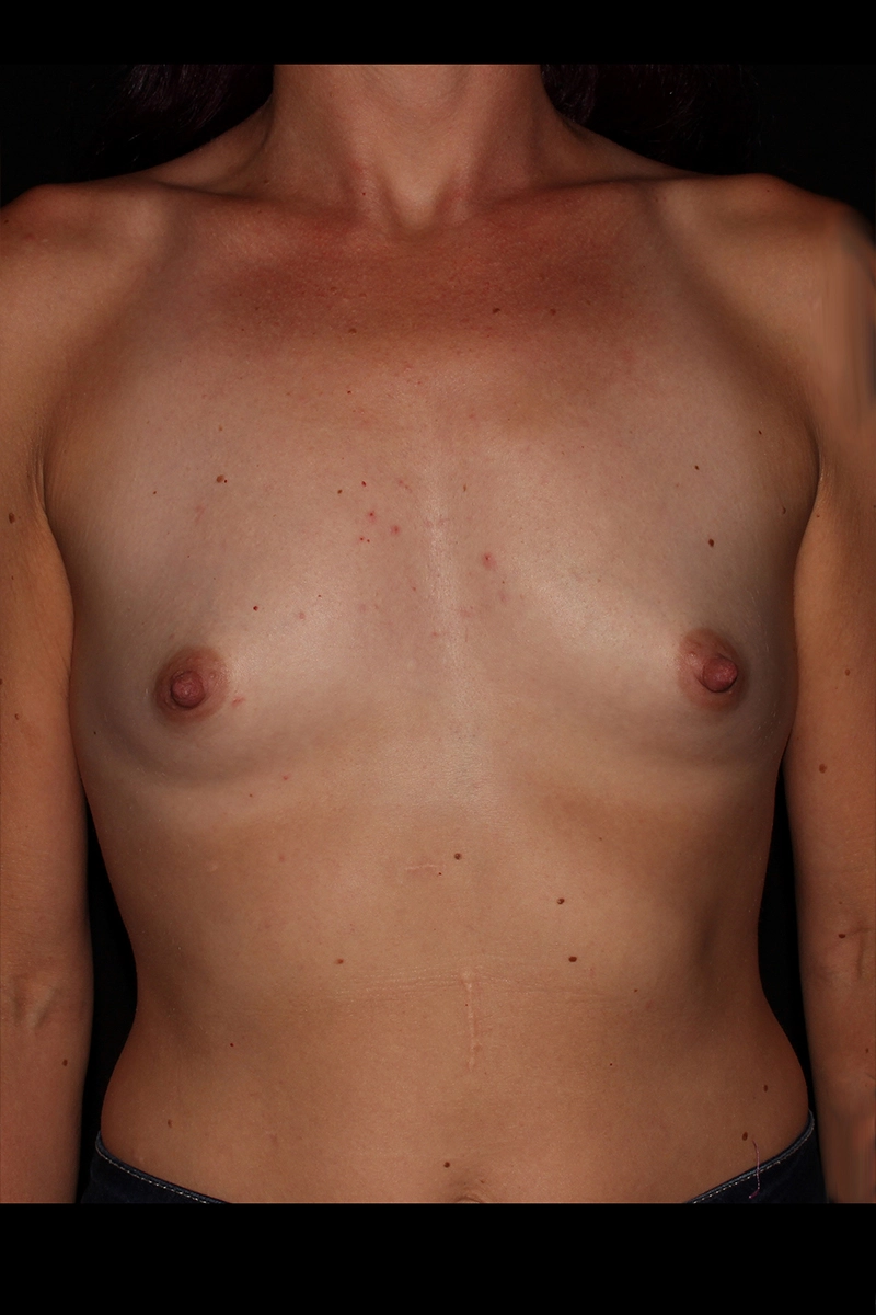 Case #4493 before_opt