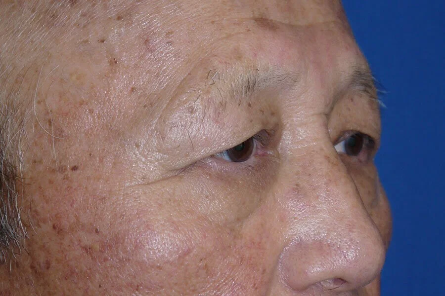 Case #17667 before right oblique