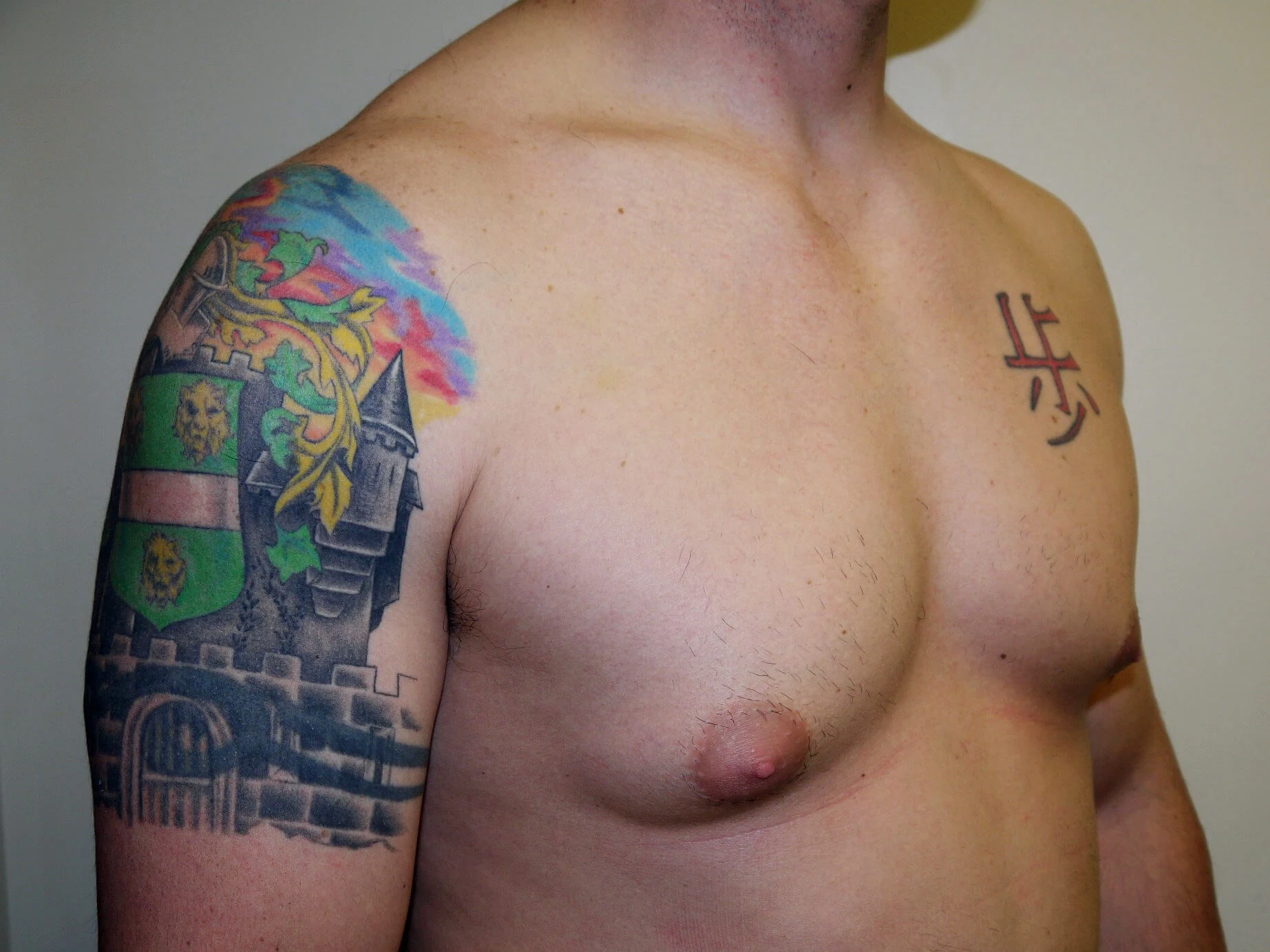 Case #36426 before right oblique