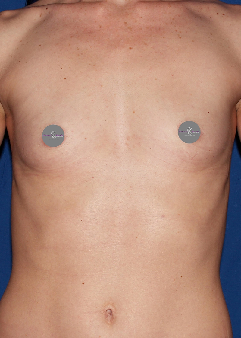 Case #31575 before_opt