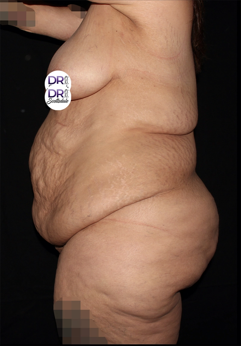 6199_1_before_opt